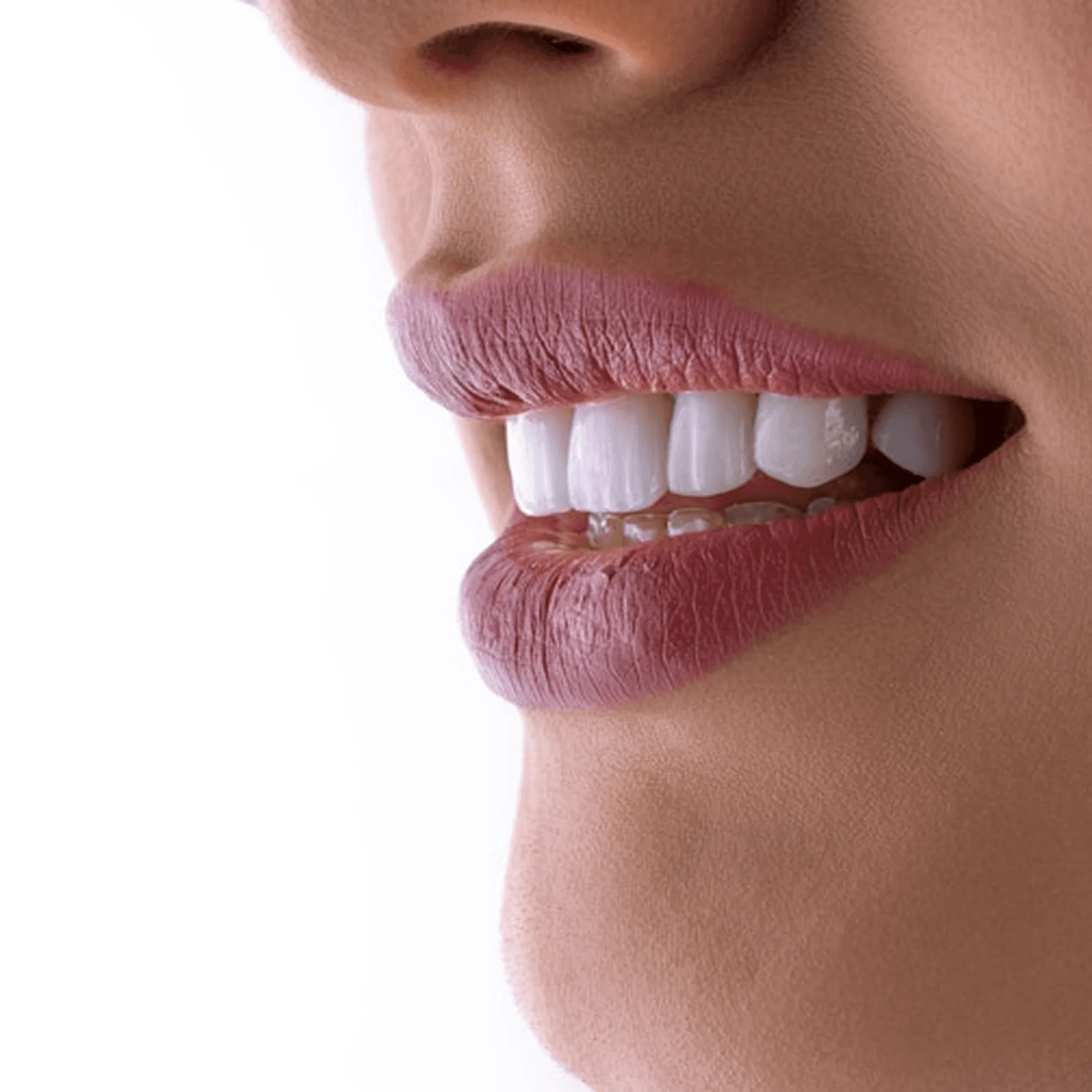 Close-up of parted lips showing clean white teeth with pink lipstick against white background.