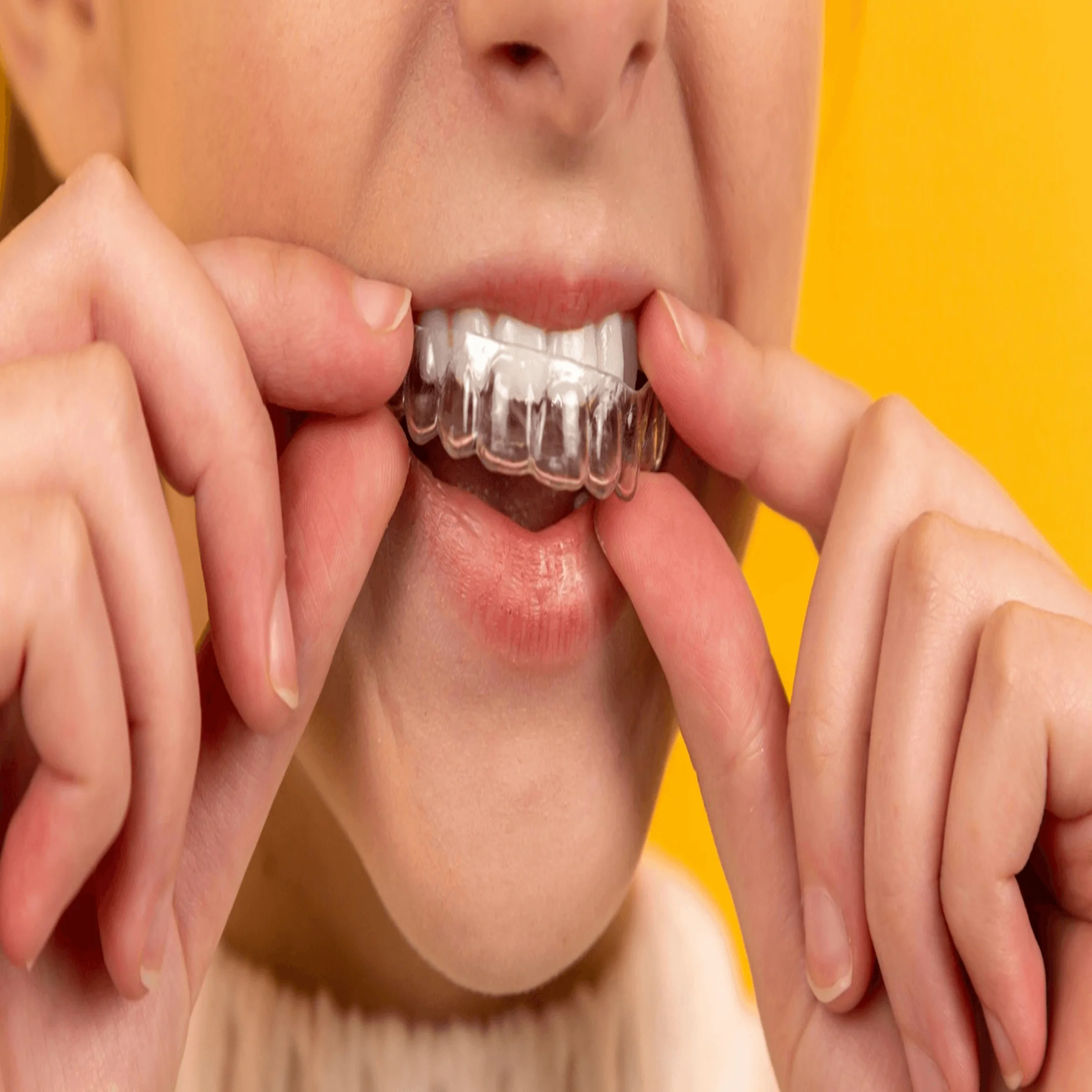 Person inserting clear dental aligner onto upper teeth against yellow background.