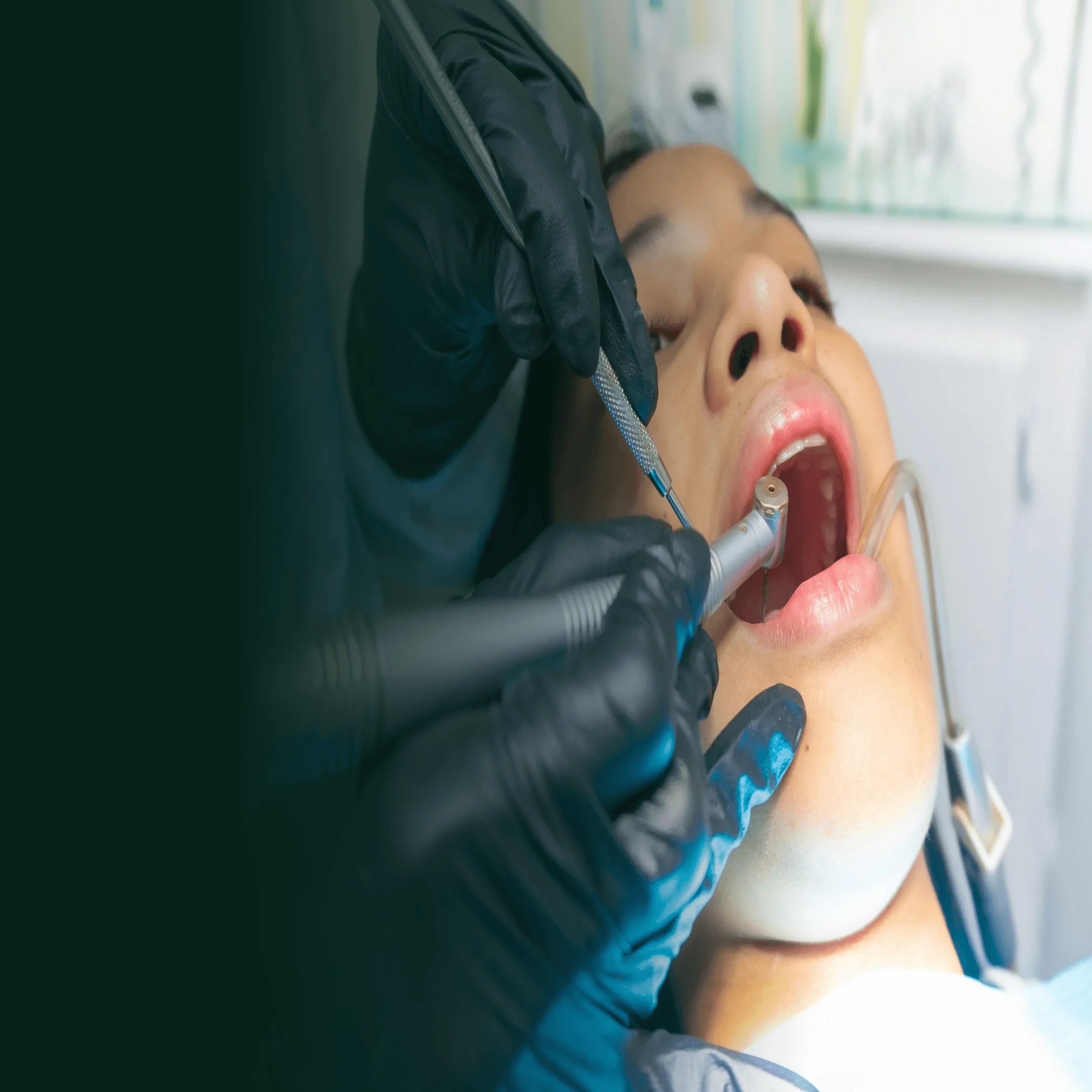 Dental professional in black gloves performing procedure with drill and mirror on patient in clinic