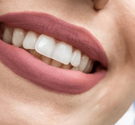 Close-up of mouth with matte mauve lipstick and clean, well-aligned teeth