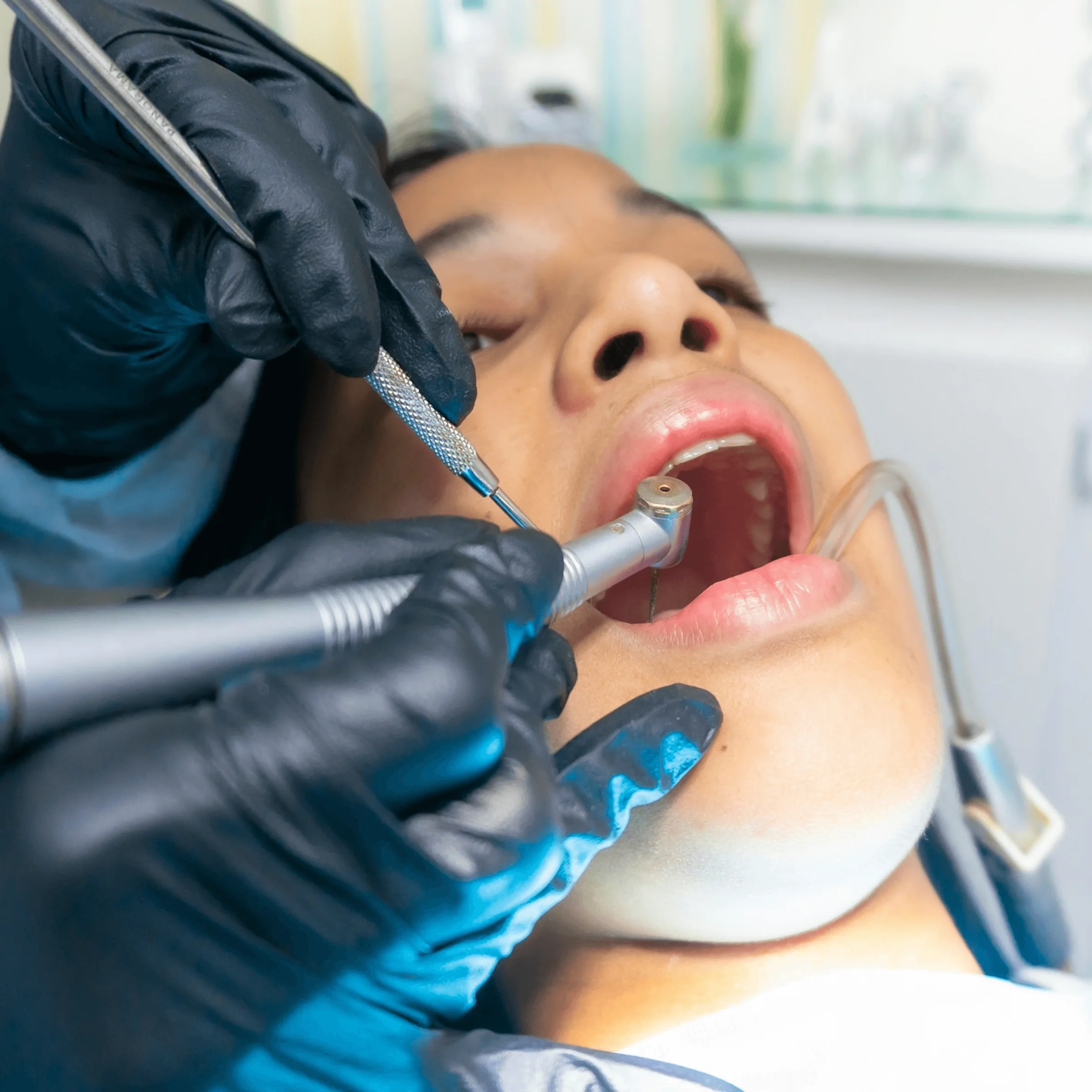 Dental professional in black gloves performing procedure with drill and mirror on patient in clinic