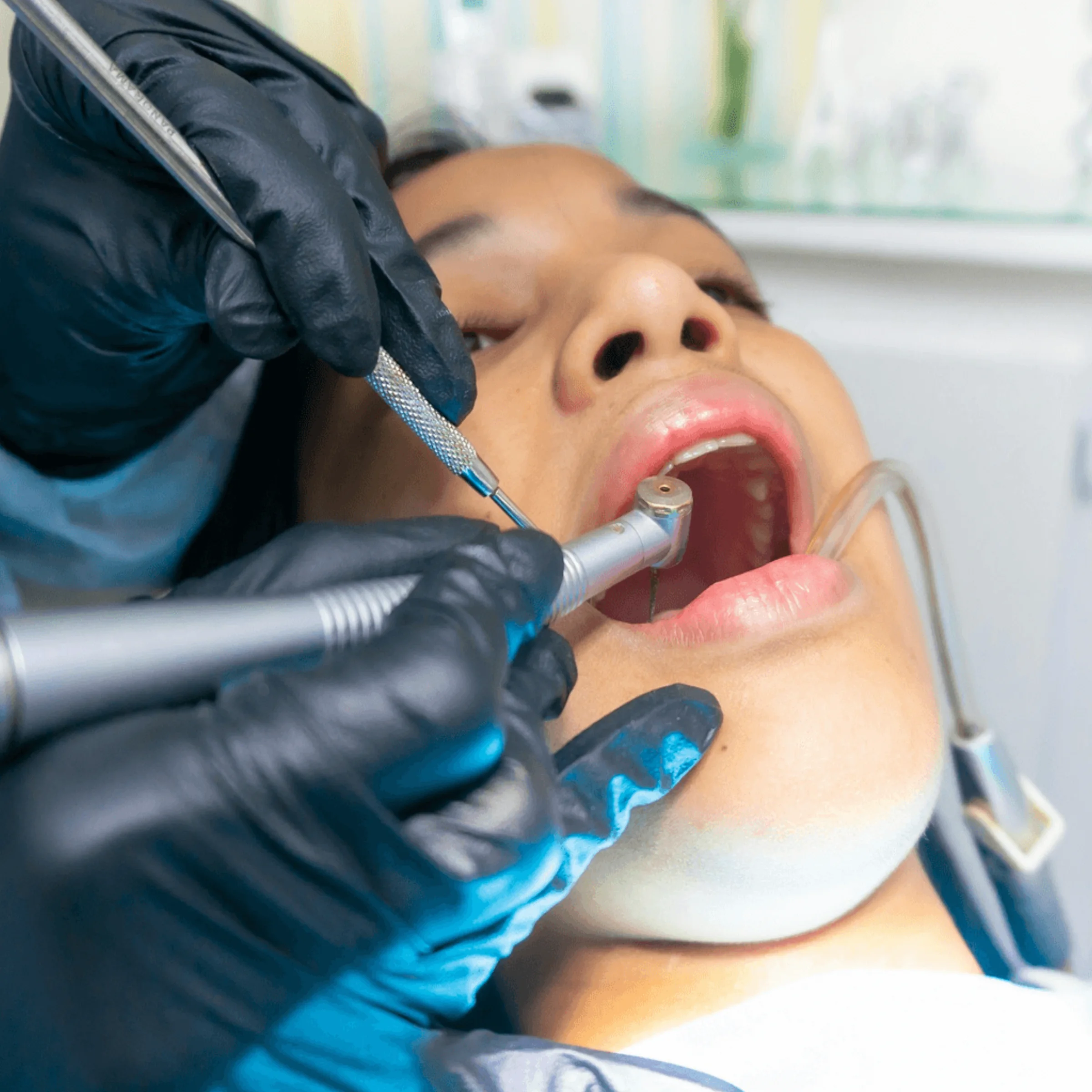 Dental professional in black gloves performing procedure with drill and mirror on patient in clinic